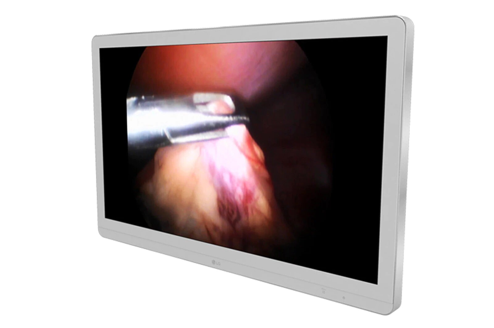 Monitor Quirúrgico 27"