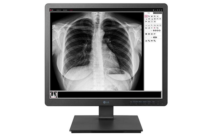 19HK312C-B Monitor Clínico 19" HD